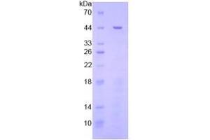 SDS-PAGE analysis of General STAT3 Protein. (STAT3 蛋白)