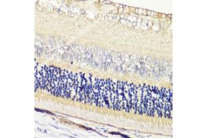 Immunohistochemistry of paraffin-embedded rat retina using GRK1 antibody  at dilution of 1:200 (40x lens). (GRK1 抗体  (AA 1-160))