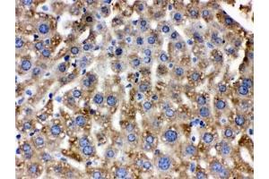 IHC testing of FFPE mouse liver with Catalase antibody. (Catalase 抗体)
