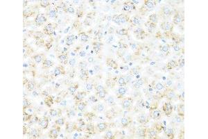 Immunohistochemistry of paraffin-embedded Mouse liver using IL7 Polyclonal Antibody at dilution of 1:100 (40x lens). (IL-7 抗体)