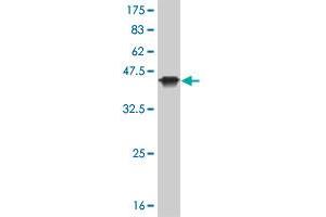 Western Blot detection against Immunogen (36. (KAT2B 抗体  (AA 353-452))