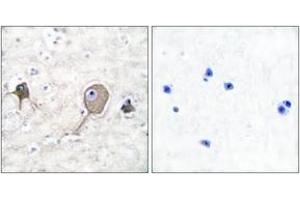 Immunohistochemistry analysis of paraffin-embedded human brain tissue, using NSE Antibody.
