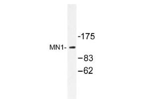 Image no. 1 for anti-MN1 proto-oncogene (MN1) antibody (ABIN317611) (Meningioma 1 抗体)