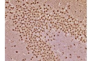 Immunohistochemistry (Paraffin-embedded Sections) (IHC (p)) image for anti-Von Hippel-Lindau Tumor Suppressor, E3 Ubiquitin Protein Ligase (VHL) (AA 101-200) antibody (ABIN872573)