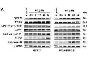 MCF-7 and MDA-MB-231 cells were treated with the indicated concentrations of BA for 24 h, and the protein levels of ER stress-associated signals were stimulated by BA in a dose-dependent manner, including GRP78, p-PERK/PERK, p-eIF2α/eIF2α, CHOP, and caspase-12. (EIF2S1 抗体  (pSer51))