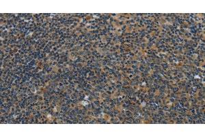 Immunohistochemistry of paraffin-embedded Human tonsil using SYN1 Polyclonal Antibody at dilution of 1:40 (SYN1 抗体)