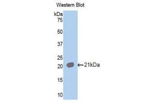 Western Blotting (WB) image for anti-Interleukin 18 Receptor 1 (IL18R1) (AA 391-518) antibody (ABIN1859373) (IL18R1 抗体  (AA 391-518))
