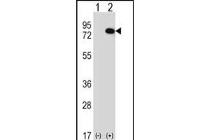 Western blot analysis of RIOK1 (arrow) using rabbit polyclonal RIOK1 Antibody (N-term) (ABIN391301 and ABIN2841337). (RIOK1 抗体  (N-Term))