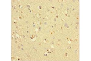 Immunohistochemistry of paraffin-embedded human brain tissue using ABIN7148316 at dilution of 1:100 (COMMD6 抗体  (AA 1-85))