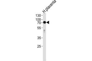 Western Blotting (WB) image for anti-Alkaline Phosphatase (ALP) antibody (ABIN2998256) (Alkaline Phosphatase 抗体)