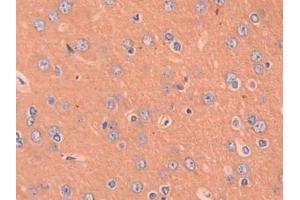 DAB staining on IHC-P; Samples: Rat Cerebrum Tissue (CCL4 抗体  (AA 24-92))