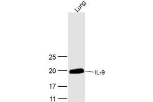Mouse lung lysates probed with IL-9 Polyclonal Antibody, Unconjugated  at 1:300 dilution and 4˚C overnight incubation. (IL-9 抗体  (AA 21-120))