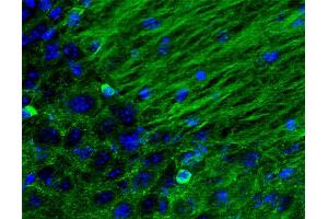 Immunohistochemistry (IHC) image for anti-tau Protein (AA 3-214) antibody (ABIN1742567) (tau 抗体  (AA 3-214))