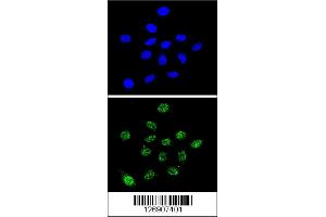 Confocal immunofluorescent analysis of DKC1 Antibody with 293 cell followed by Alexa Fluor 488-conjugated goat anti-rabbit lgG (green). (DKC1 抗体  (AA 185-213))