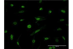 Immunofluorescence of monoclonal antibody to HNRNPM on HeLa cell. (HNRNPM 抗体  (AA 17-112))