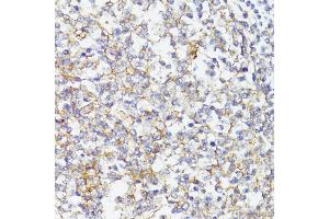 Immunohistochemistry of paraffin-embedded Human tonsil using CD276/B7-H3 antibody (ABIN7266182) at dilution of 1:100 (40x lens). (CD276 抗体  (AA 100-200))