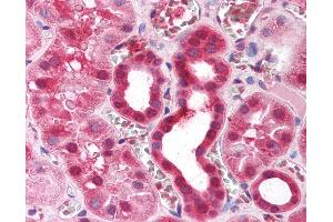 Immunohistochemistry (IHC) image for anti-Zinc Finger Protein 36, C3H Type, Homolog (Mouse) (ZFP36) (AA 84-133) antibody (ABIN214153)