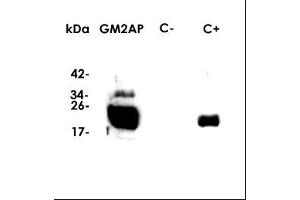 Western-Blot (Dilution 1:1000 in PBS) , kDA: molecular weight marker , GM2AP: recomb. (GM2A 抗体  (Isoform 1))