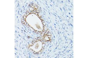 Immunohistochemistry of paraffin-embedded rat uterus using δ-Catenin/p120 Catenin Rabbit pAb (ABIN3022308, ABIN3022309, ABIN3022310, ABIN1512791 and ABIN6218725) at dilution of 1:50 (40x lens). (CTNND1 抗体  (AA 573-832))