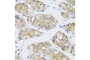 Immunohistochemistry of paraffin-embedded human gastric using FGF13 antibody at dilution of 1:100 (x40 lens). (FGF13 抗体)