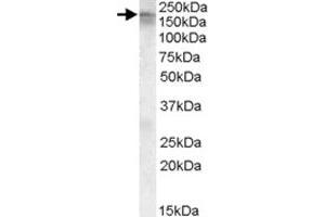 CACNA1C polyclonal antibody  (0. (CACNA1C 抗体)