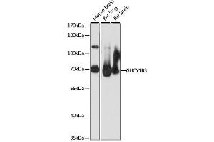 Western blot analysis of extracts of various cell lines, using GUCY1B3 antibody. (GUCY1B3 抗体)
