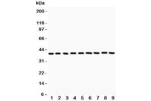 Western blot testing of APE1 antibody and Lane 1:  rat NRK;  2: human HeLa;  3: (r) PC12;  4: (r) RH35;  5: mouse HEPA;  6: (h) MCF7: (h) A549;  8: (h) placenta;  9: (h) A431. (APEX1 抗体  (AA 2-318))