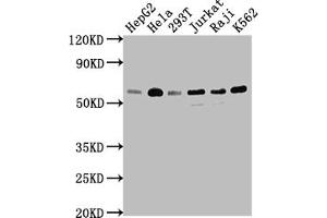 Western Blot Positive WB detected in: HepG2 whole cell lysate, Hela whole cell lysate, 293T whole cell lysate, Jurkat whole cell lysate, Raji whole cell lysate, K562 whole cell lysate All lanes: TRAF2 antibody at 1:1500 Secondary Goat polyclonal to rabbit IgG at 1/50000 dilution Predicted band size: 56, 62, 55, 54 kDa Observed band size: 56 kDa (Recombinant TRAF2 抗体)