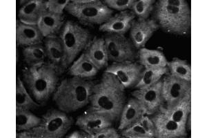 Immunofluorescent staining of A549 (ATCC CCL-185) cells. (GNB2L1 抗体  (AA 113-317))