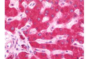 Immunohistochemistry (IHC) image for anti-Inhibitor of kappa Light Polypeptide Gene Enhancer in B-Cells, Kinase epsilon (IKBKE) (AA 123-636) antibody (ABIN1960176)