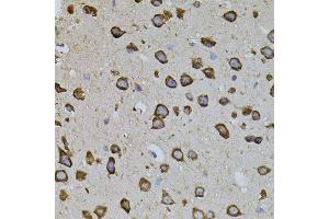 Immunohistochemistry of paraffin-embedded mouse brain using IRF1 antibody. (IRF1 抗体)