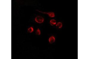 ABIN6275180 staining Hela by IF/ICC. (GNL1 抗体)