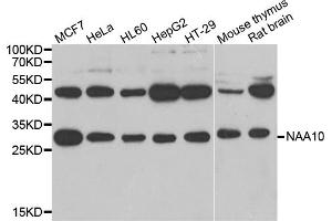 Western blot analysis of extracts of various cell lines, using NAA10 antibody. (NAA10 抗体)