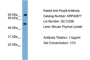 WB Suggested Anti-Parp8 Antibody Titration:  0. (PARP8 抗体  (C-Term))
