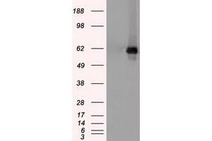 Western Blotting (WB) image for anti-Checkpoint Kinase 2 (CHEK2) antibody (ABIN1497495) (CHEK2 抗体)