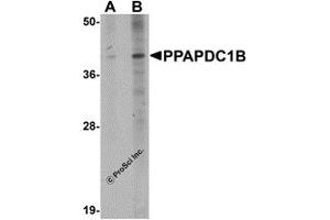 Western Blotting (WB) image for anti-Phosphatidic Acid Phosphatase Type 2 Domain Containing 1B (PPAPDC1B) (N-Term) antibody (ABIN1031523) (PPAPDC1B 抗体  (N-Term))