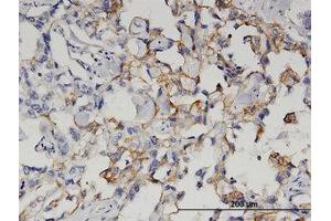 Image no. 1 for anti-Glutaminyl-Peptide Cyclotransferase (QPCT) (AA 262-360) antibody (ABIN599543) (QPCT 抗体  (AA 262-360))