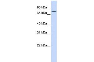 WB Suggested Anti-ASH2L Antibody Titration: 0. (ASH2L 抗体  (N-Term))