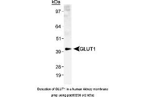 Image no. 2 for anti-Solute Carrier Family 2 (Facilitated Glucose Transporter), Member 1 (SLC2A1) (AA 1-100), (N-Term) antibody (ABIN363548) (GLUT1 抗体  (N-Term))
