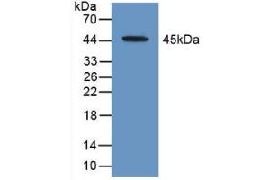 Detection of Recombinant ACAT2, Human using Polyclonal Antibody to Acetyl Coenzyme A Acetyltransferase 2 (ACAT2) (ACAT2 抗体  (AA 1-397))