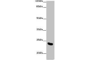 Western blot All lanes: AICDA antibody at 10 μg/mL + Mouse liver tissue Secondary Goat polyclonal to rabbit IgG at 1/10000 dilution Predicted band size: 24, 23 kDa Observed band size: 24 kDa (AICDA 抗体  (AA 1-60))