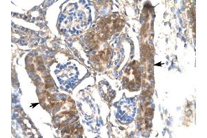 Immunohistochemistry (IHC) image for anti-Solute Carrier Family 17 (Anion/Sugar Transporter), Member 2 (SLC17A2) antibody (ABIN635573)