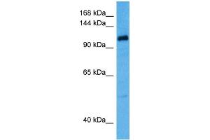 Host:  Rabbit  Target Name:  KCNQ5  Sample Tissue:  Human OVCAR-3 Whole Cell lysates  Antibody Dilution:  1ug/ml (KCNQ5 抗体  (C-Term))