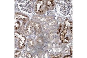 Immunohistochemical staining of human kidney with HEATR6 polyclonal antibody  shows strong cytoplasmic positivity in a subset of tubules. (HEATR6 抗体)
