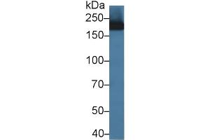 Detection of CD11b in Rat Bone marrow lysate using Polyclonal Antibody to Integrin Alpha M (CD11b) (CD11b 抗体  (AA 31-160))