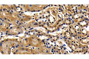 Immunohistochemistry (IHC) image for anti-Toll-Like Receptor Adaptor Molecule 1 (TICAM1) (AA 263-526) antibody (ABIN7441427)