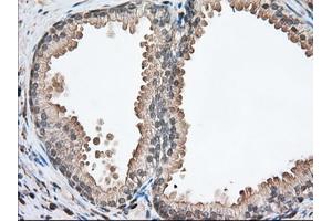 Immunohistochemical staining of paraffin-embedded Human pancreas tissue using anti-PFN1 mouse monoclonal antibody. (PFN1 抗体)