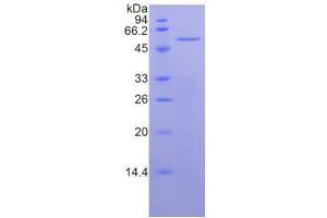 SDS-PAGE analysis of Human Mesothelin Protein. (Mesothelin Protein (MSLN))
