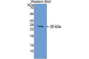 Western blot analysis of the recombinant protein. (C1QBP 抗体  (AA 72-279))