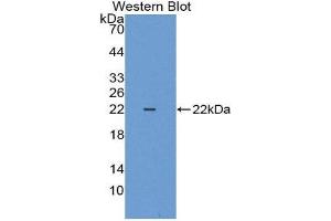 Western Blotting (WB) image for anti-Keratin 18 (KRT18) (AA 1-159) antibody (ABIN3207040) (Cytokeratin 18 抗体  (AA 1-159))